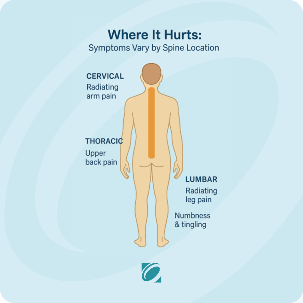 Infographic - Degenerative Disc Disease Symptoms