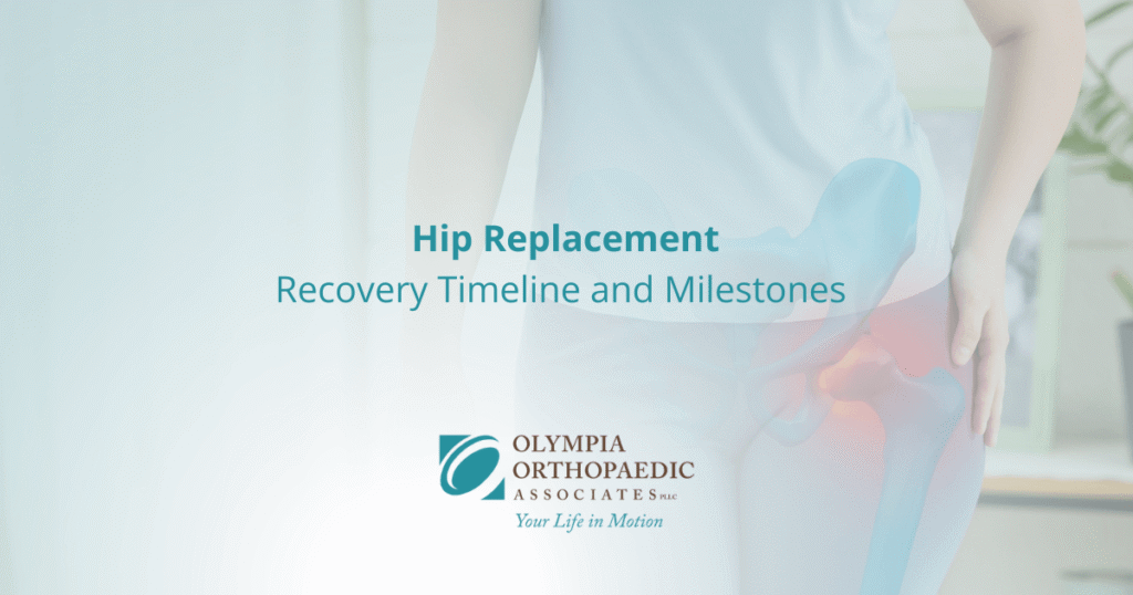 Hip Replacement: Recovery Timeline and Milestones (hero image)